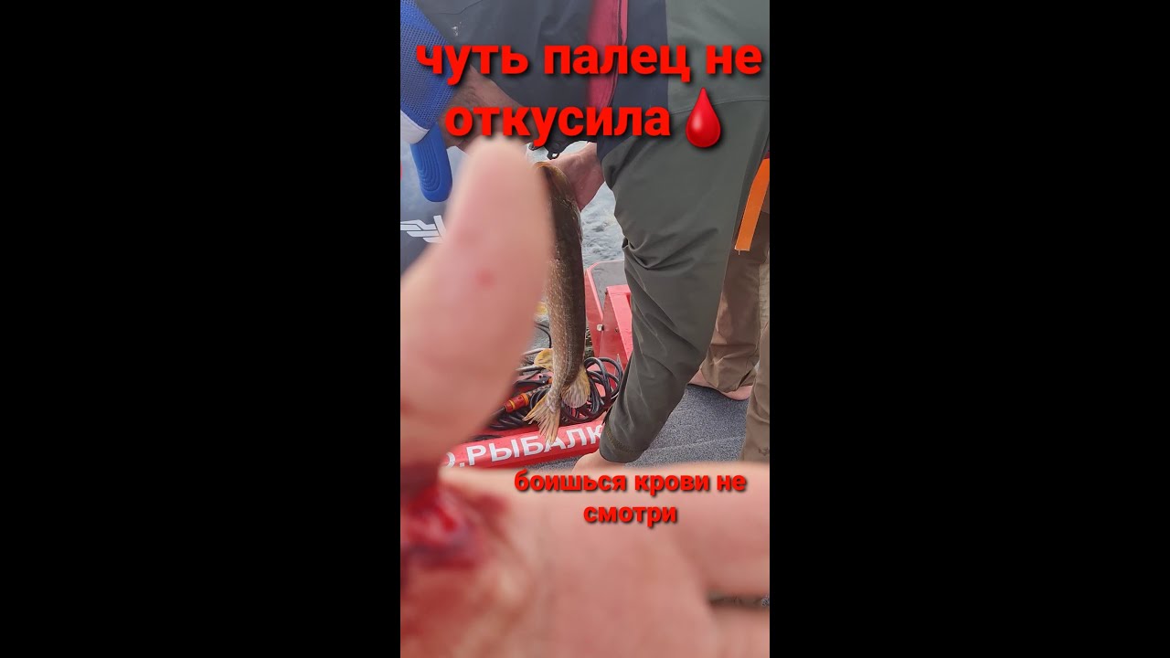 укус щуки, слабонервным не смотреть😅