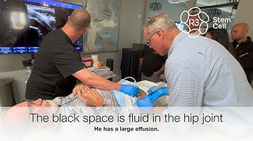 Ultrasound Guided Hip Injection with R3 Stem Cell (844) GET-STEM