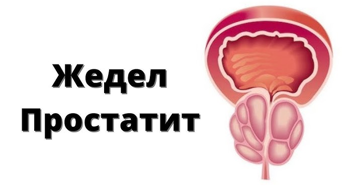 Дефлорация порно видеоларын қараңыз