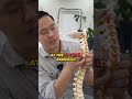 The Truth About A Chiropractic Y-Strap