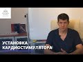 Кардиостимулятор сердца: показания, установка, противопоказания.