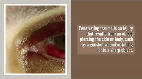 An Overview of Clasification of Trauma | Dr. Antho...