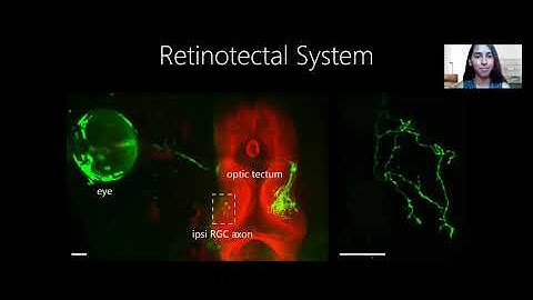 Tasnia Rahman, McGill University - Stentian structural plasticity in the developing visual system