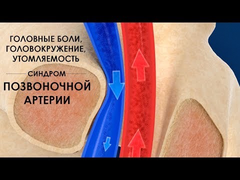 Видео: Причини за заболяване на коронарната артерия