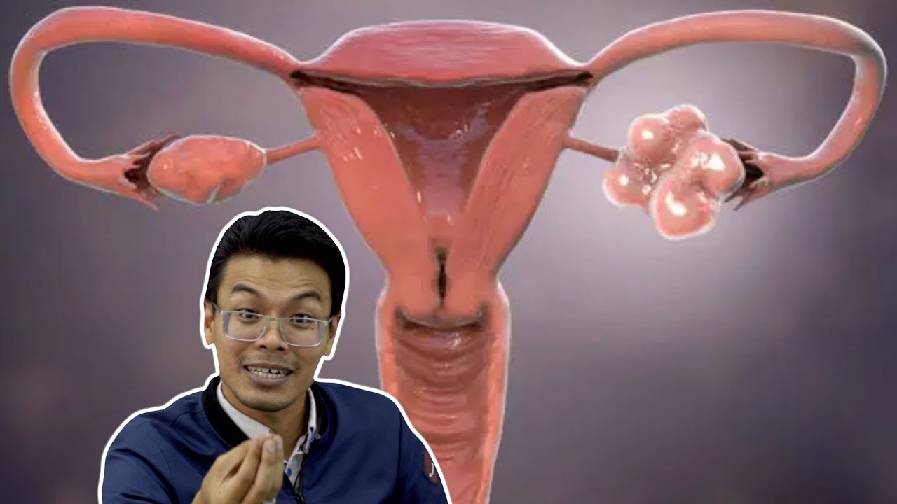 Macam Mana Wanita Nak Check Kesuburan?