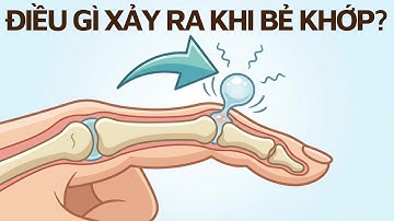 Điều Gì Sẽ Xảy Ra Khi Bạn Bẻ Các Khớp? #diendantrithuc