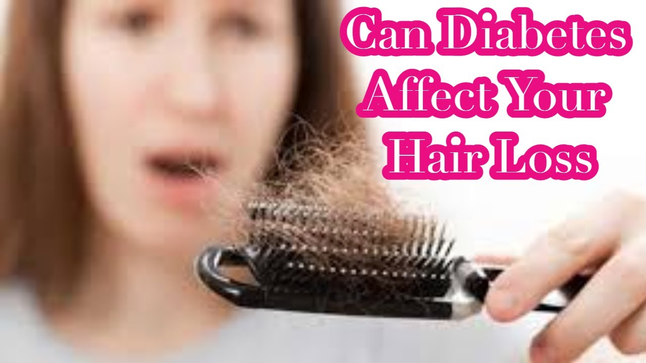Can Diabetes Affect Your Hair Loss Does Diabetes Cause Hair Loss
