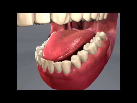 Orthodontic: Invisalign | Lake Merritt Dental, Oakland, CA