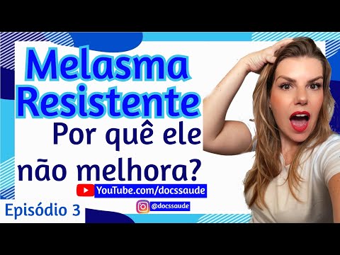 A pomada milagrosa para melasma resistente