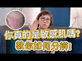 敏感肌會有哪些症狀？是什麼原因導致肌膚敏感？莊盈彥醫師詳細告訴你！