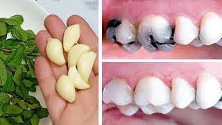 How To Reverse Cavities And Heal Tooth Decay By This Remedy