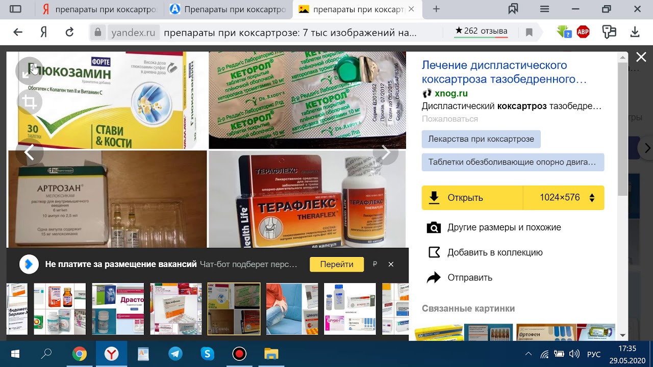 Самые эффективные препараты при коксартрозе тазобедренного сустава