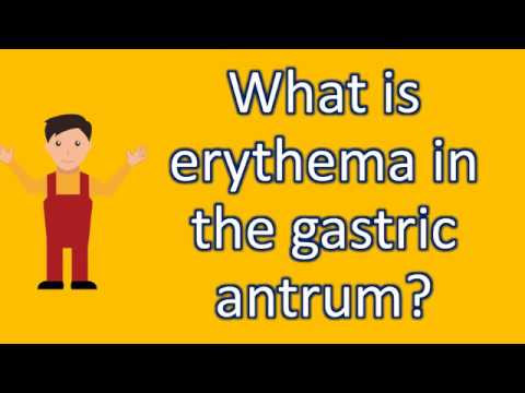 Video: Erythematous gastropathy