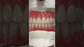 Beautiful Denture Try-In #lsk121shorts #dental #teeth