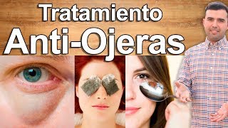 Ojeras bueno los y que es las en para ojos bolsas