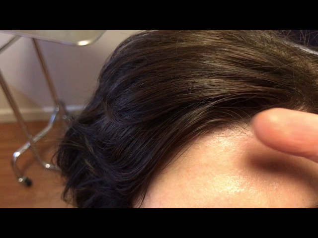 Dallas Female Natural (Untransplanted) Hairline Series #3