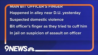 Man bites off part of officer's finger during arrest, police say