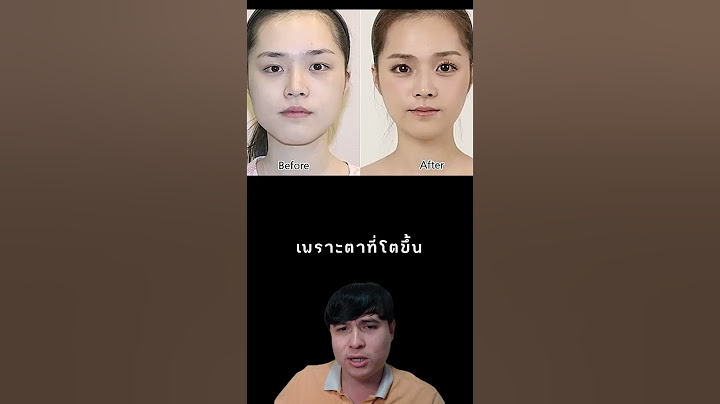 ศัลยกรรมขั้นเทพที่เกาหลีทำให้นักท่องเที่ยวเกือบเข้าประเทศตัวเองไม่ได้ #ศัลยกรรม #เกาหลี #shorts