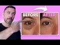 HOW TO: MAKE EYE BAGS VANISH IN SECONDS! FULL DEMO!