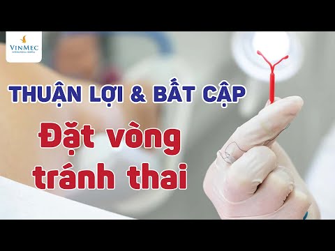 Video: Kéo cắt: mô tả, ưu điểm và nhược điểm