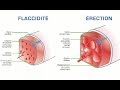 Rection  pourquoi des pannes 