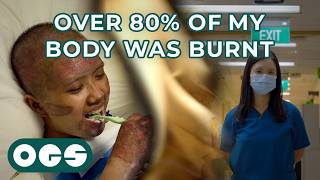 The Doctor with Third Degree Burns