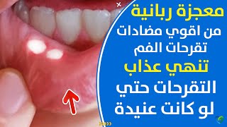 تعرف على أهم علاج فطريات الفم والطرق البسيطة لذلك