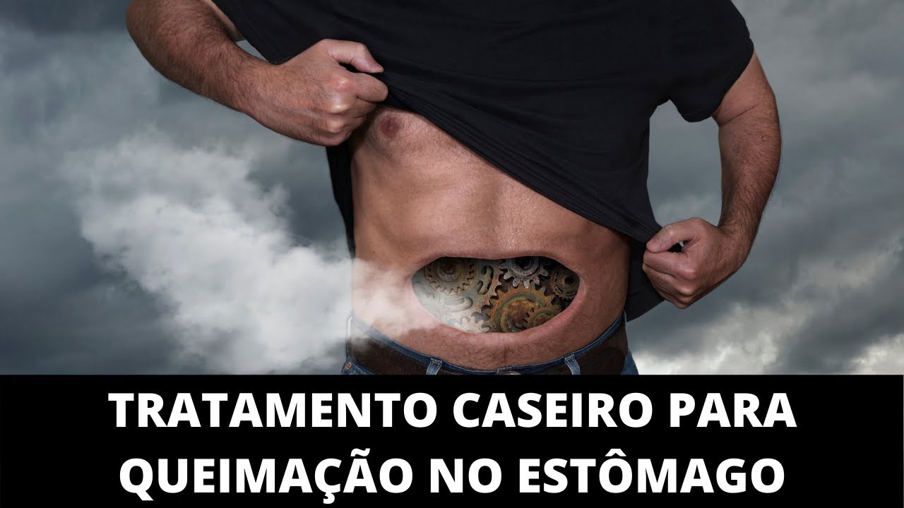 Termo Tecnico Para Queimação No Estomago - RETOEDU