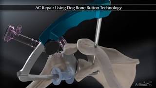 AC Repair Using the Dog Bone Button Technology