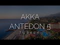 Обзор отеля Akka Antedon 5*. Турция 2021. Отзыв о отеле Akka Antedon. Viko travel