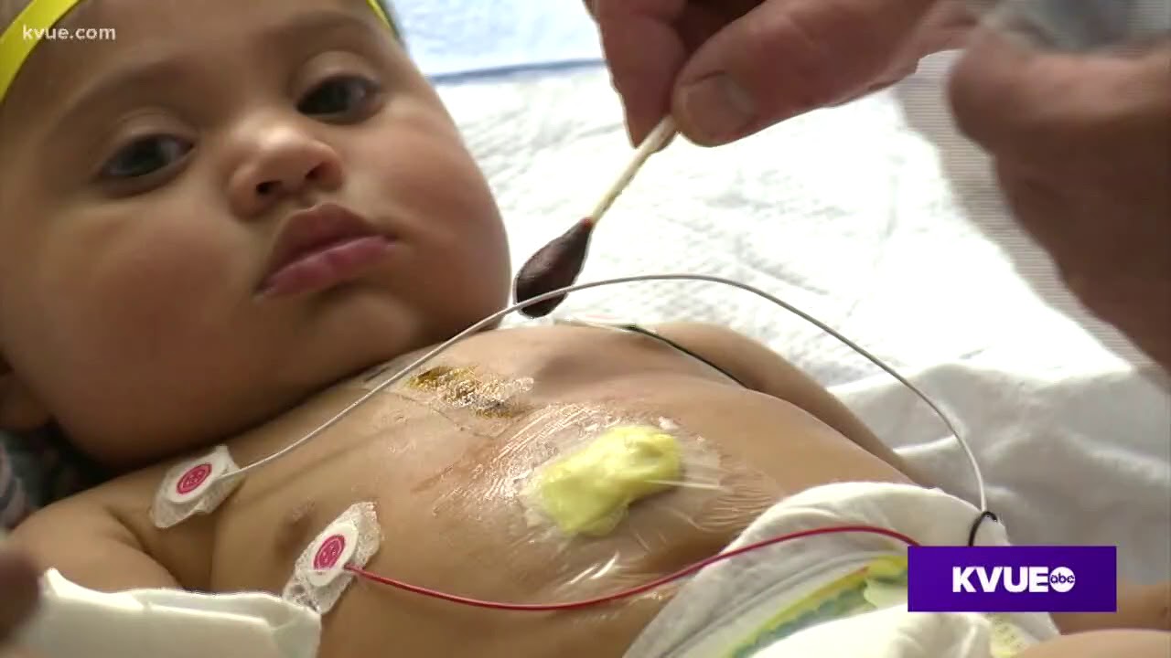 New heart surgery center helping infants