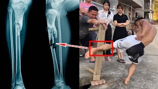 The Terrifying Iron Legs Have A Strength Of Up To 983 Kilograms