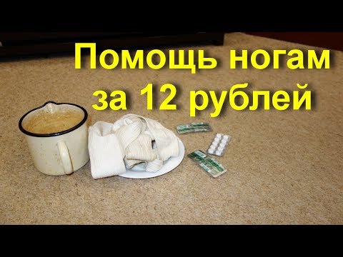 Лечение варикоза. Аптечное простое копеечное средство при варикозе и тянущих венах на ногах | расширение | варикозное | варикоза | лечение | варикоз | лечить | ногах | как | вен | на