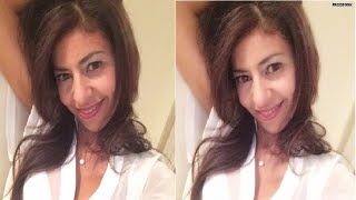 'Selfie surgery' is real -- and it's on the rise Wealth