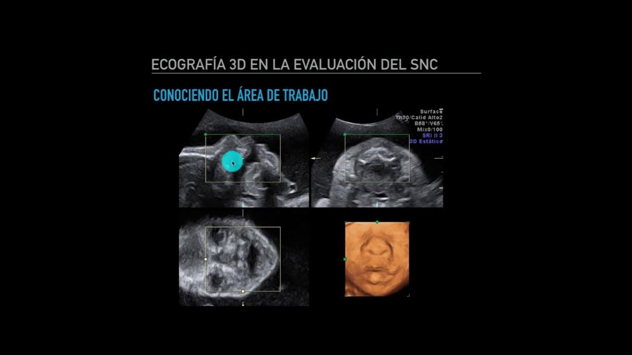 Cuanto cuesta una ecografia 4d