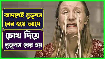 কাদলেই চোখ দিয়ে নুডুলস বের হয় । Cinemon Mini