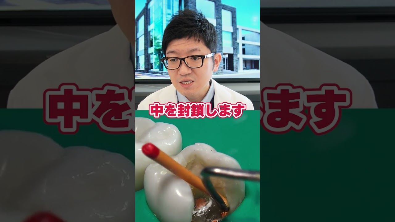 歯茎の中まで進行😱虫歯治療を先生が解説！#shorts