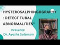 Hysterosalpingography a comprehensive guide  gynecological insights ayeshamdsuleman