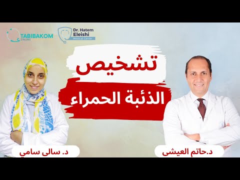 تشخيص الذئبة الحمراء مع د سالي
