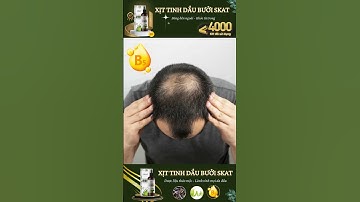 Tóc mỏng, tóc rụng? Giải pháp tinh dầu bưởi cho nam để có mái tóc mạnh mẽ