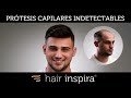 Hair Replacements - Hair Inspira