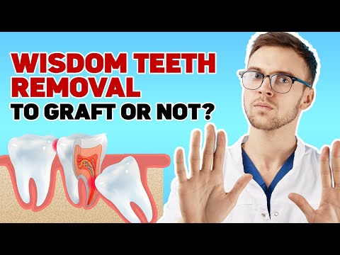 Wisdom Teeth Removal: To Graft or Not? 🦷❓