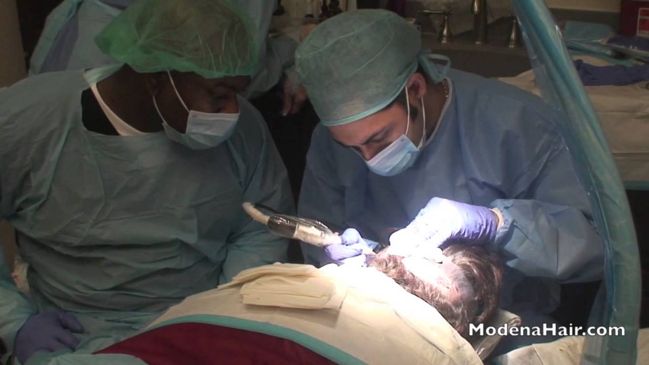 Modena FUE Hair Transplant Las Vegas & Orange County YouTube