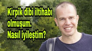 Kirpik dibi iltihabı (Blefarit) nedir, nasıl tedavi edilir? Nasıl kurtuldum? screenshot 4