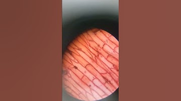 Onion peel under Microscope