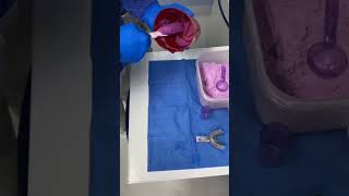 alginate impression, step by step