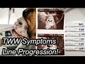 TWW Symptoms | Pregnancy Test Line Progression | TTC Journey!