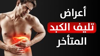 أعراض تليف الكبد المتأخر و أسبابه