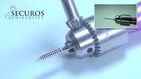 SECUROS University Tips & Tricks: Bone Anchor
