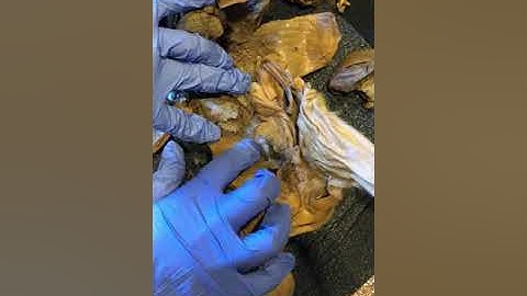 Week 8 | Video Lab Exercise - Reproductive System